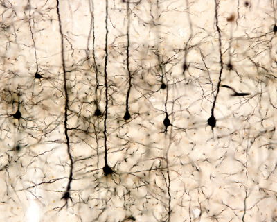 O tecido nervoso apresenta como célula principal os neurônios