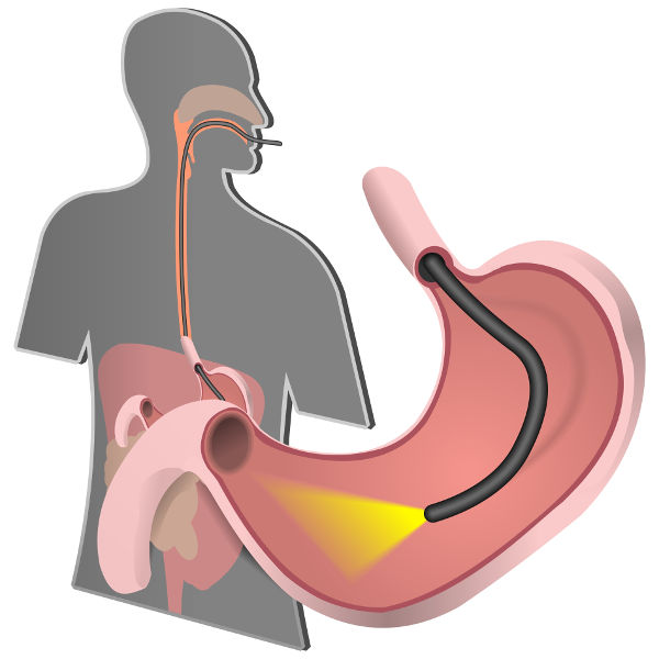Uma fibra óptica especial é usada para realizar exames de endoscopia.