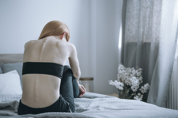 Mulher com anorexia.