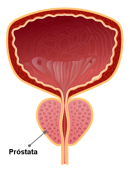 A próstata é um órgão em formato de noz, localizado abaixo da bexiga.